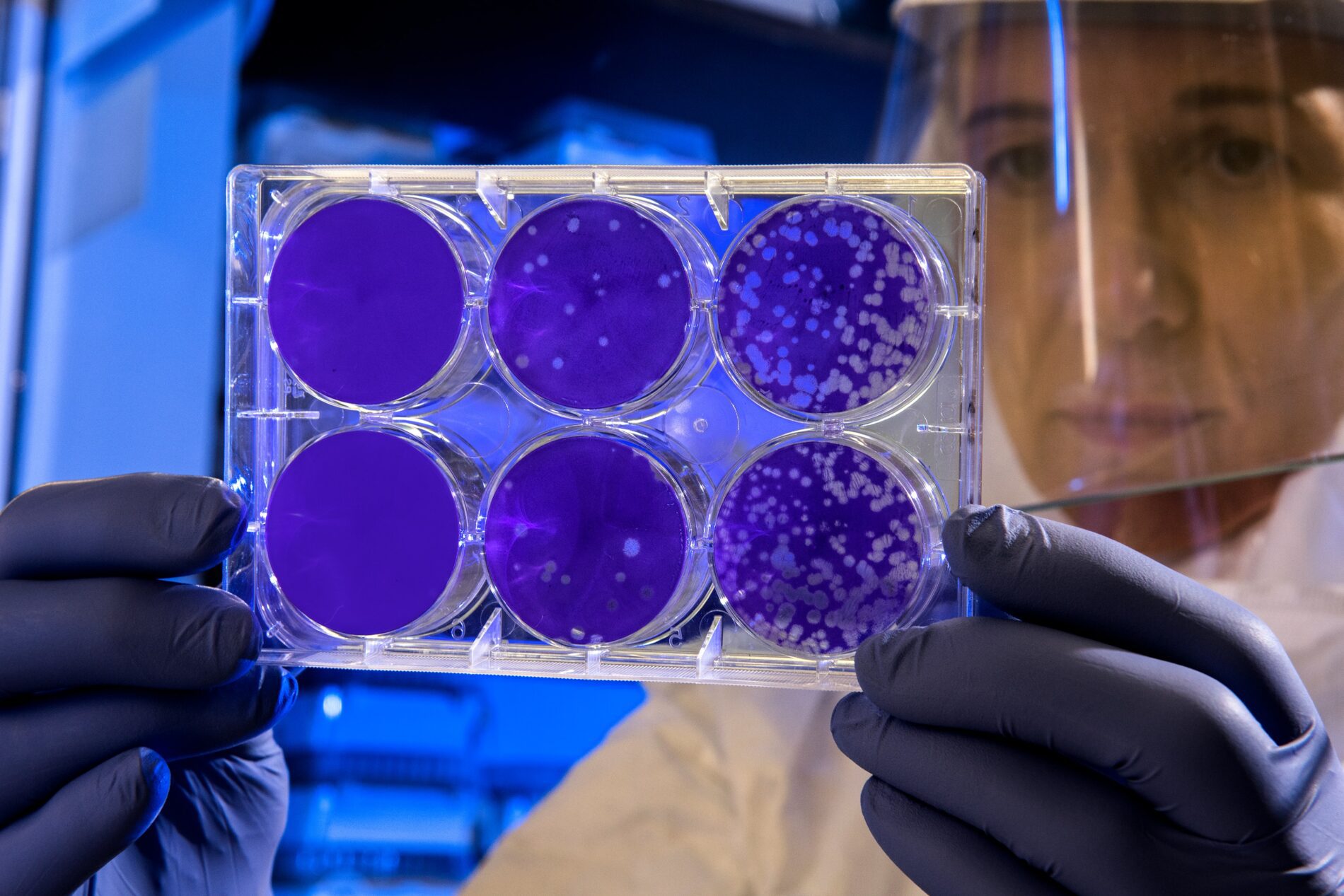 Биологи создали новый тип клеток человека для исследований